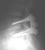 5_OH/2000_08_pam_xray.jpg